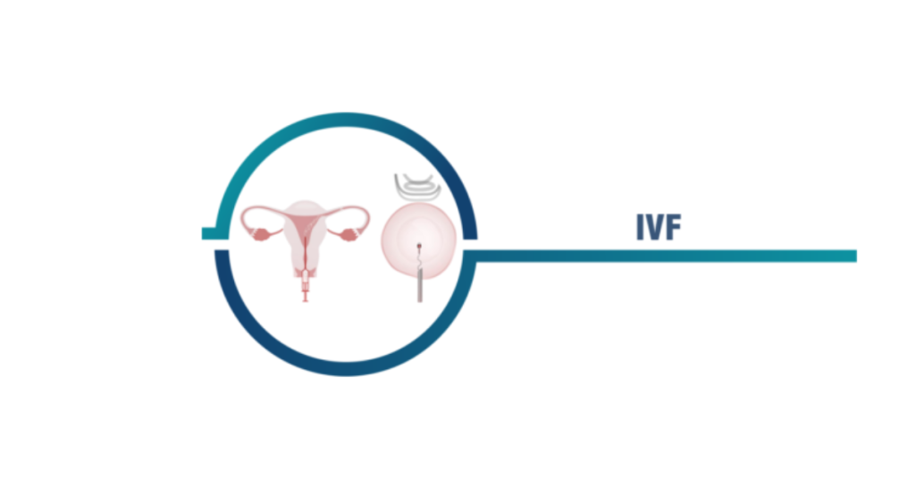 affordable IVF cost in Indore
