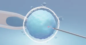 ICSI treatment in indore